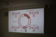 Na ekranie wyświetlony slajd ze schematem cyklu menstruacyjnego.